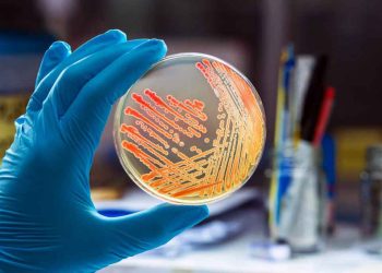 Revealing the Robust Microbial Ecosystem Within Microwaves