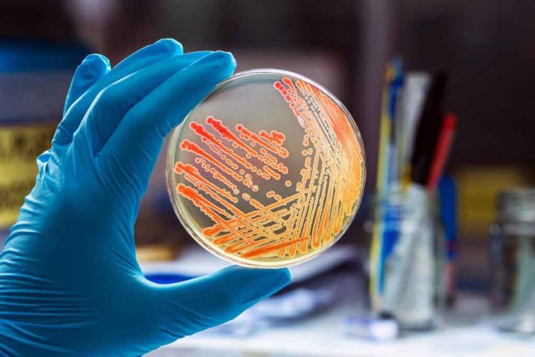 Revealing the Robust Microbial Ecosystem Within Microwaves