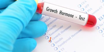 Navigating the Complex Terrain of Growth Hormone Therapy in Children: Balancing Height and Health